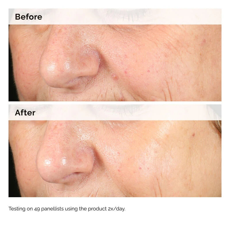 The Ordinary (Direct Acids) Alpha Arbutin 2% + HA 60ml