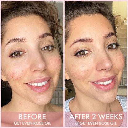 Wishful Get Even Rose Face Oil